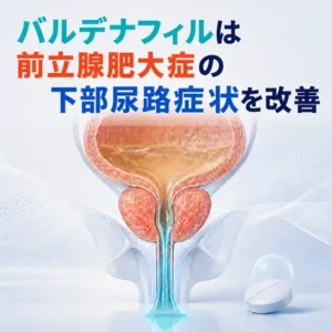 バルデナフィルには、適応症はないものの、前立腺肥大症による下部尿路症状を改善する効果がある